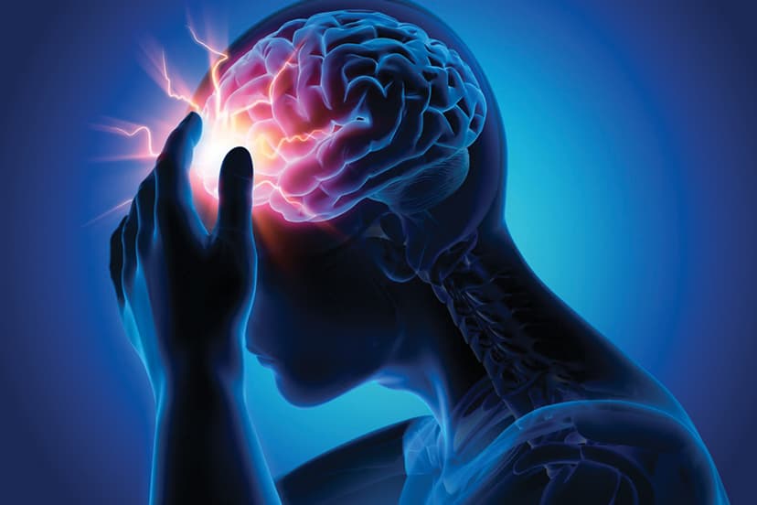 Epilepsy Brain